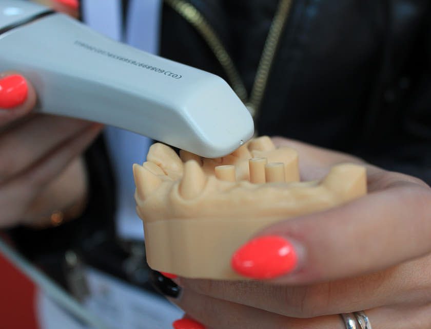Empleada con las uñas pintadas de naranja sosteniendo una prótesis dental y un instrumento de laboratorio dental.