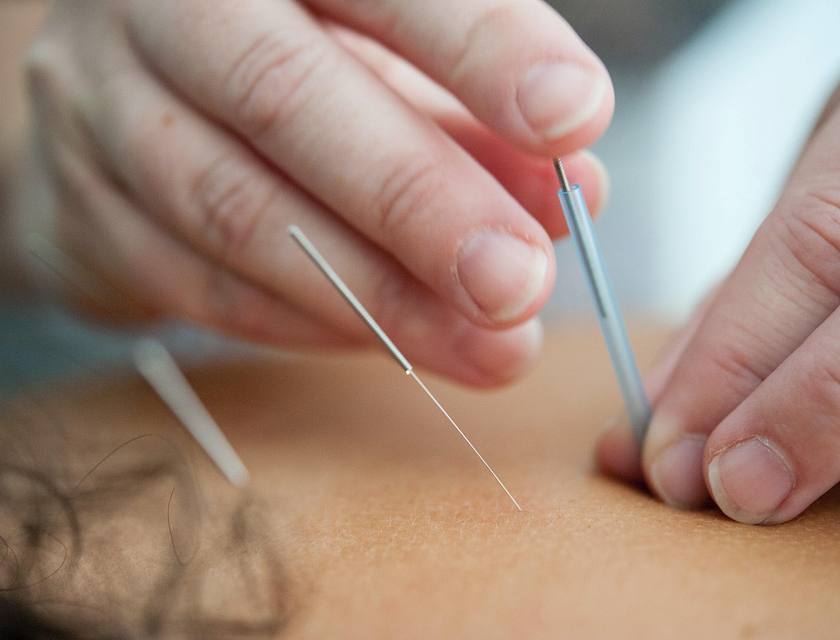 Dry Needling Business Names