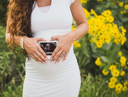 Una donna incinta che mostra la propria ecografia effettuata in un centro di diagnosi prenatale.