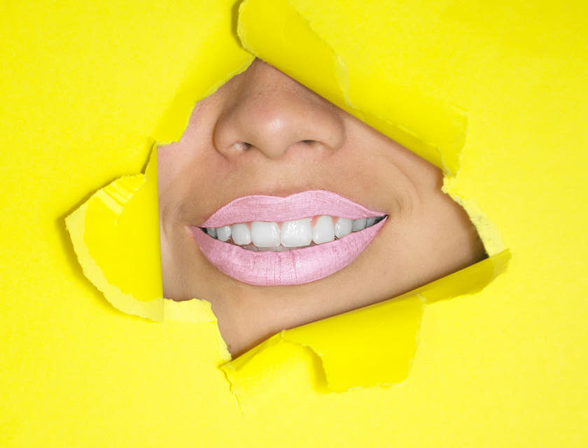 Una bocca che sorride con rossetto rosa e denti bianchi, appena uscita da uno studio di sbiancamento dentale.