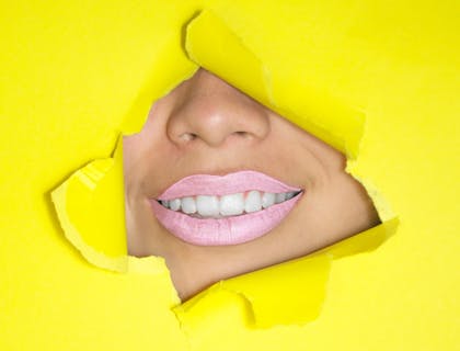Boca con blanqueamiento dental en fondo amarillo.