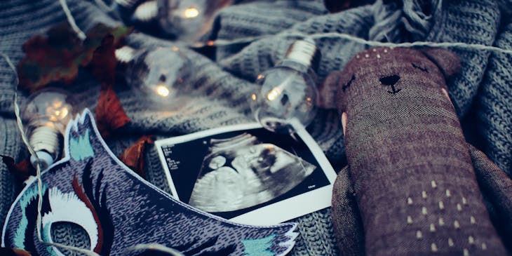 A scan from an ultrasound imaging center for an expecting mother.